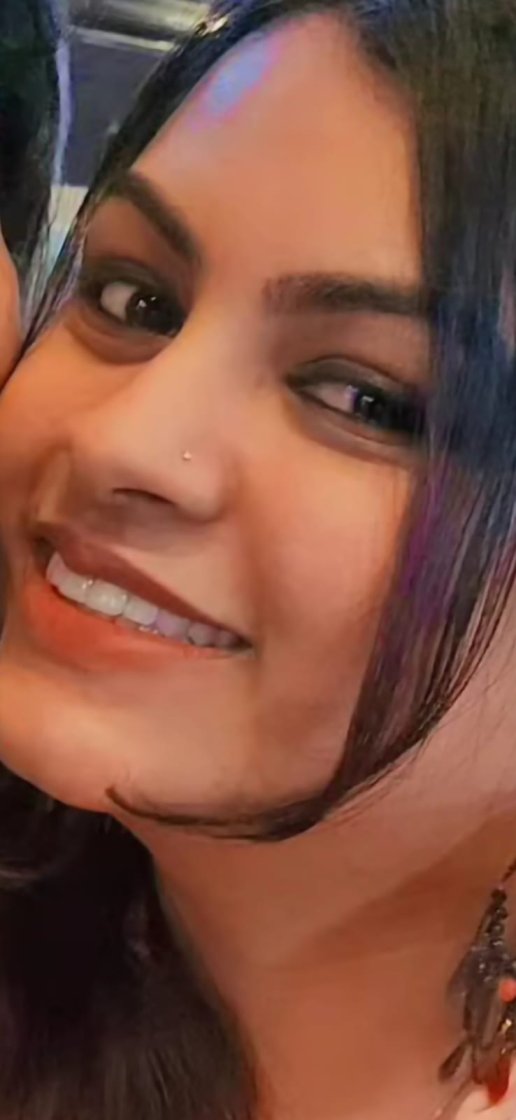 After whitening
