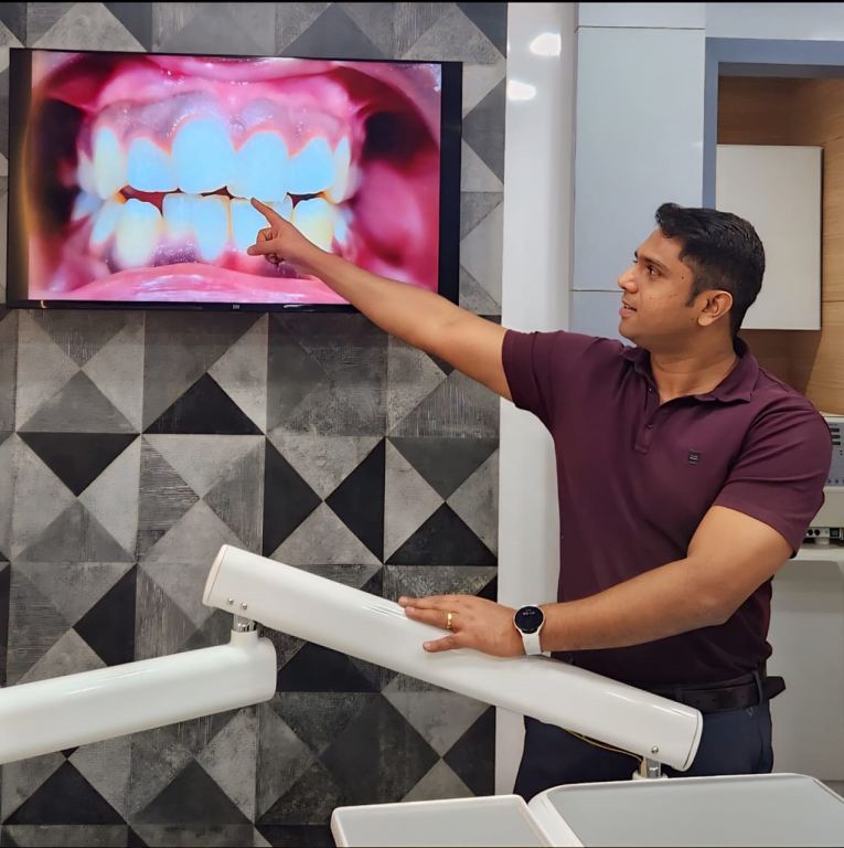 Free Smile Analysis Your Personalised Smile Roadmap at Aspen Dental Care RT Nagar