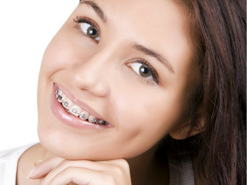Aspen Dental Care Orthodontics