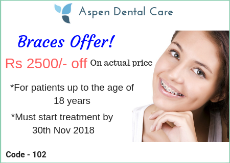offers at Aspen Dental Care