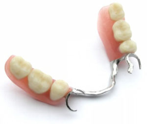 Aspen Dental Care Dentures Bangalore