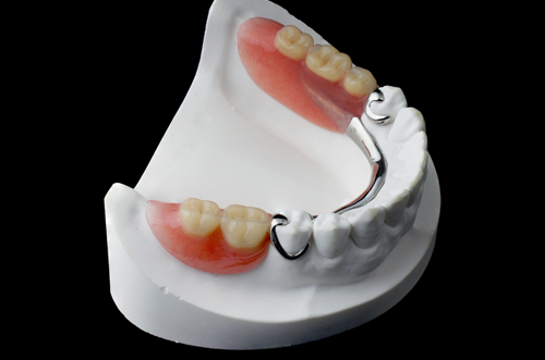 Aspen Dental Care Missing Teeth Bangalore