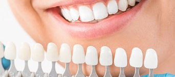 Aspen Dental Care Tooth Filling Bangalore
