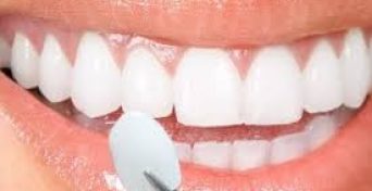 Aspen Dental Care Lumineers Bangalore